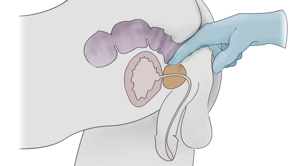 Diagram of where the male prostate is