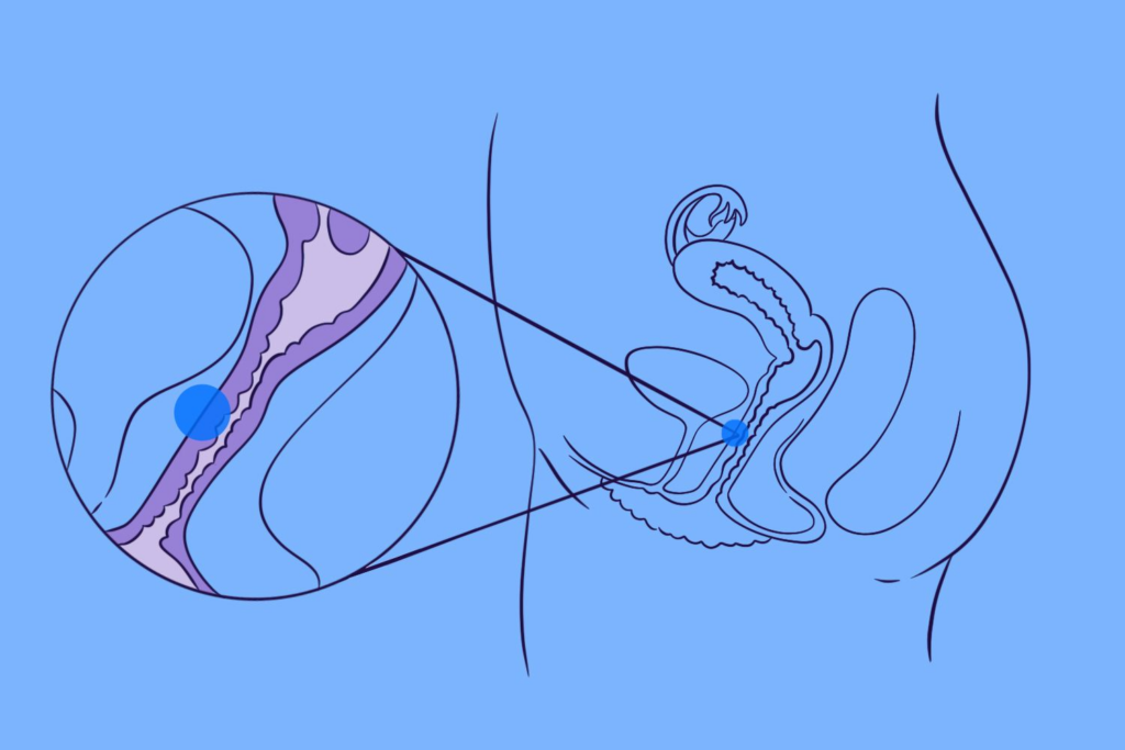 diagram of G-spot location